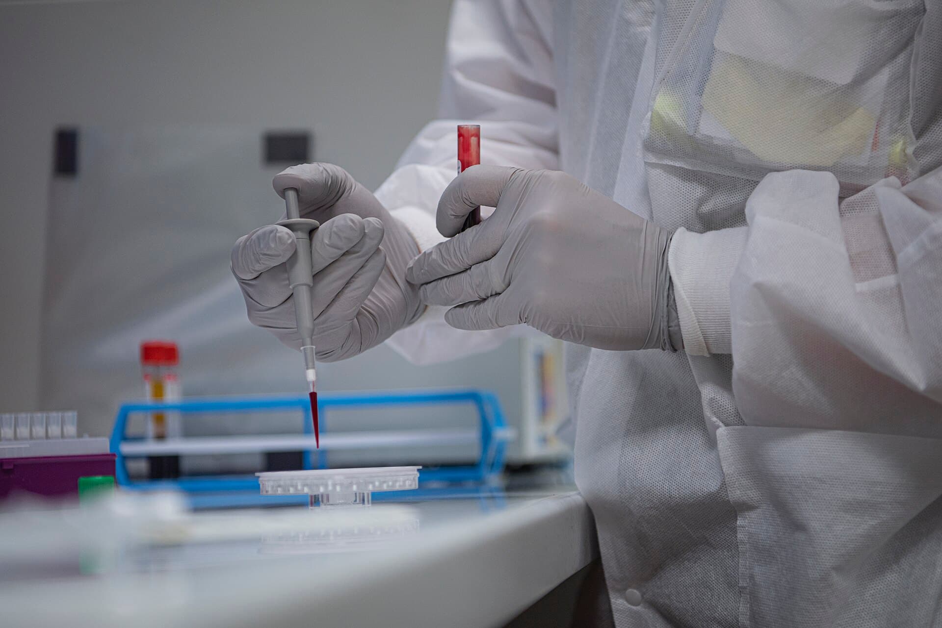 A gloved hand holds a vial of blood during a medical procedure.